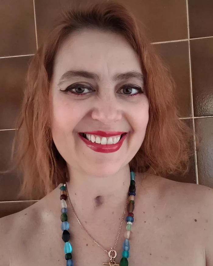 Perempuan Ini Alami Lumpuh Usai Makan Pesto Kedaluwarsa, Dirawat di RS hingga Setahun