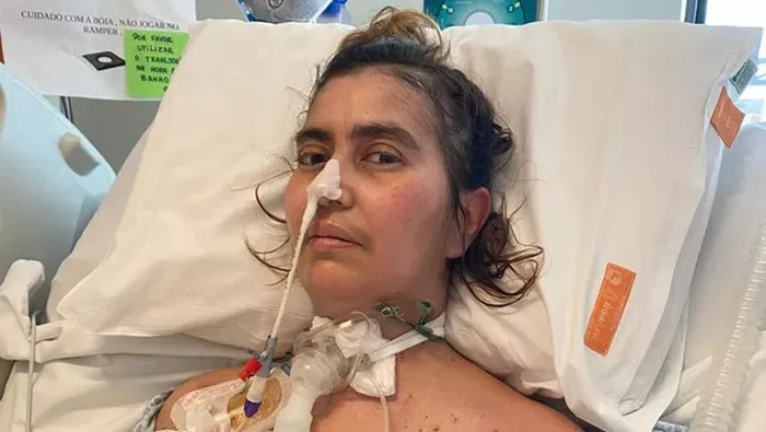 Perempuan Ini Alami Lumpuh Usai Makan Pesto Kedaluwarsa, Dirawat di RS hingga Setahun