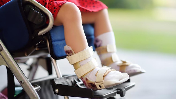 Disabled girl sitting in wheelchair. On her legs orthopedic equipment . Child cerebral palsy. Inclusion. Family with disabled kid.