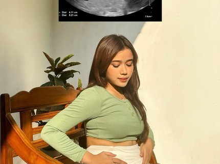 Cara Unik Brisia Jodie Hadapi Body Shaming hingga Disebut Hamil
