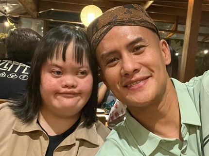 5 Potret Choky Sitohang Bersama Sang Adik Down Syndrom, Jadi Berkat di Keluarga