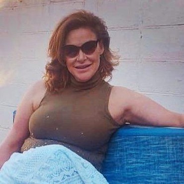 Eks Ratu Kecantikan Argentina Meninggal Dunia Usai Operasi Plastik