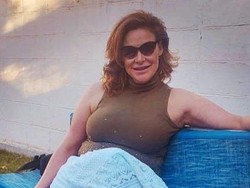 Eks Ratu Kecantikan Argentina Meninggal Dunia Usai Operasi Plastik