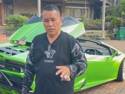 Curhat Hotman Paris Alami Penyumbatan Pembuluh Darah, Pasang 3 Ring Jantung