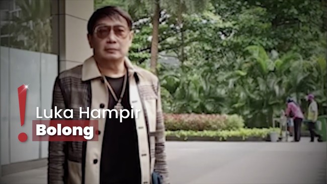 Gegara Diabetes, Adjie Notonegoro Harus Jalani Operasi Amputasi