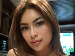 Model Echa Frauen Operasi Payudara-Transfer Lemak ke Muka: Biar Tambah Pede
