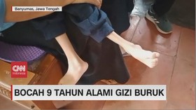 VIDEO: Bocah 9 Tahun Alami Gizi Buruk