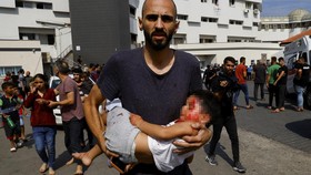 FOTO: Tangis dan Darah Anak-anak Korban Perang Israel-Hamas