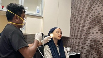 KONDISI TERKINI SYBILL USAI ALAMI IRITASI TELINGA