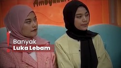 Keluarga Curiga Dini Sera Meninggal Bukan Karena Sakit Jantung dan Lambung