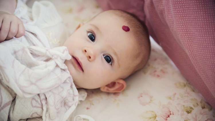 Hemangioma pada Anak