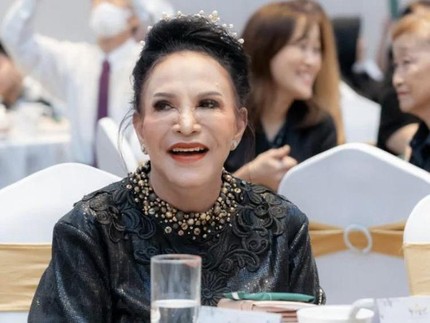Mpok Atiek Cerita Awal Mula Terkena Tumor Usus, Alami Sembelit dan Sempat Dikira GERD