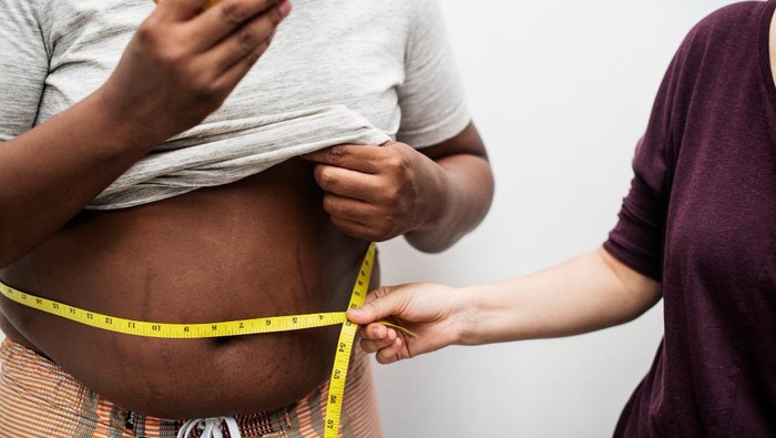 5 Area Tubuh yang Seringkali Menggelap Akibat Obesitas, Kenali Tandanya!