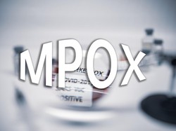 Kemenkes Catat 88 Kasus Mpox, Pintu Masuk RI Diperketat!