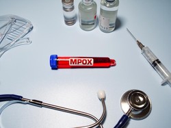 Dinkes Ungkap Hasil Kontak Erat 2 Kasus Baru Mpox di DKI