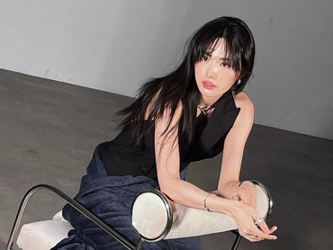 Begini Kondisi Terkini Nana Usai Terluka gegara Lawan Perampok di Rumah