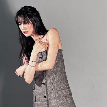 Penampakan Tato di Tubuh Nana eks After School yang Makin Pudar