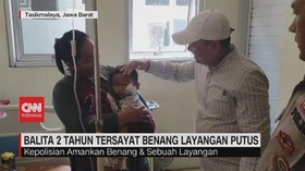 VIDEO: Balita 2 Tahun Tersayat Benang Layangan Putus