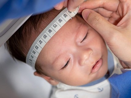 Cara Mengukur Lingkar Kepala Bayi yang Benar untuk Ketahui Ukuran Normal atau Tidak