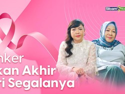 Kisah Para Kartini Indonesia Berdamai dengan Kanker Payudara