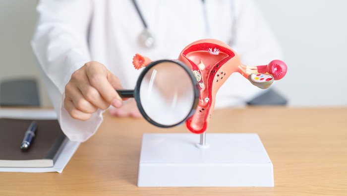 Doctor with Uterus and Ovaries anatomy model and magnifying glass. Ovarian and Cervical cancer, Cervix disorder, Endometriosis, Hysterectomy, Uterine fibroids, Reproductive system, Pregnancy
