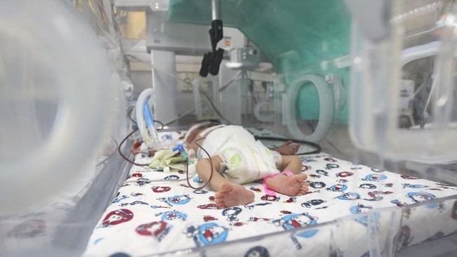 Bayi dan pasien yang dirawat di RS Aqsa di Gaza bisa berakhir di kuburan massal akibat krisis listrik di tengah agresi Israel.