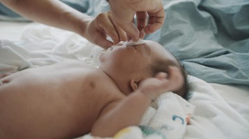 KATARAK PADA BAYI DIOBATI DENGAN CARA PEMBEDAHAN