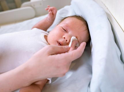 Penyebab Mata Bayi Baru Lahir Belekan Terus, Bahayakah untuk Kesehatannya?