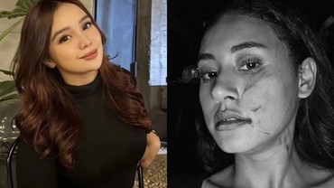 img-title Ini Regi Nazlah yang Diduga Aniaya Selebgram Afifah Riyad secara Brutal