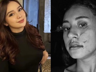 Ini Regi Nazlah yang Diduga Aniaya Selebgram Afifah Riyad secara Brutal