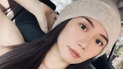 Sosok Vissi, Dokter Gigi Cantik yang Dianiaya dan Diancam Dibunuh eks Pasiennya