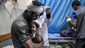 FOTO: Dampak Brutal Perang Terhadap Anak-anak Gaza