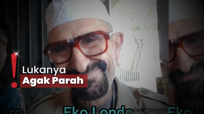 Cak Suro Ungkap Pelawak Eko Londo Masih Koma usai Alami Kecelakaan Motor