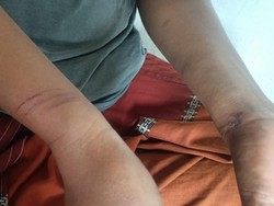 Heboh Pria di Kuansing Dipukuli-Diduga Jadi Korban Salah Tangkap BNN