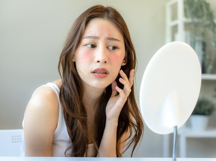 Ketahui Ciri-ciri Alergi Skincare pada Wajah, Jangan Teruskan Pemakaian Bun