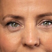 Sering Dikira Sama, Yuk Ketahui Perbedaan Fine Lines dan Wrinkle!