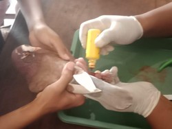 Cincin di Burung Tak Bisa Lepas hingga Bengkak, 2 Pria Klaten Sambat ke Damkar