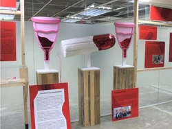 Museum Vagina Dibuka Lagi, Gelar Pameran Tentang Kista Coklat