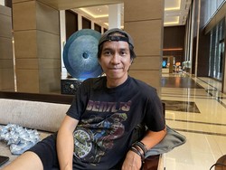 Ridho Slank Anggap Transplantasi Rambut Karya Seni