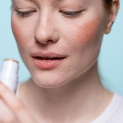 Kenali Penyebab Bibir Kering dan Pecah-Pecah, Begini Cara Mengatasinya Menurut Ahli