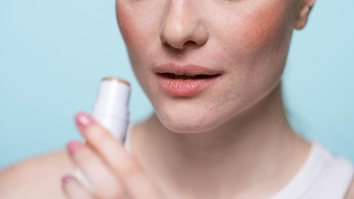 Kenali Penyebab Bibir Kering dan Pecah-Pecah, Begini Cara Mengatasinya Menurut Ahli