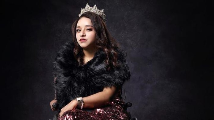 Kenalan dengan Sosok Kimi, Ratu Kecantikan Penyandang Disabilitas yang Menginspirasi
