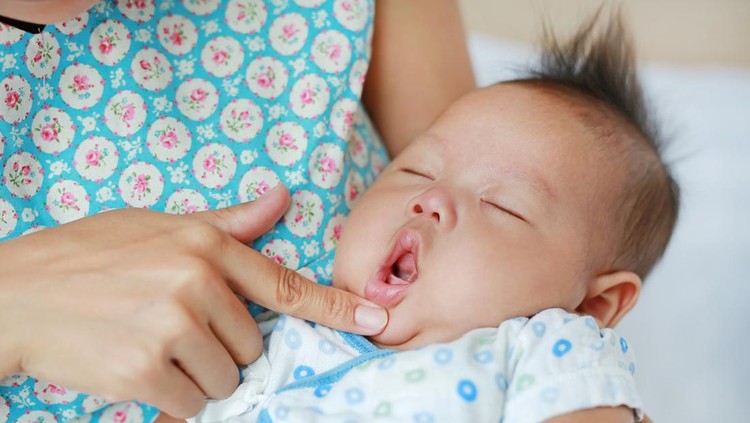 Lip Tie pada bayi