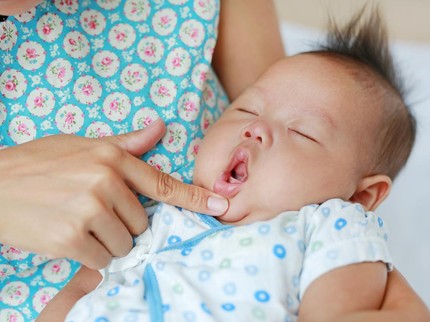Ciri-ciri Lip Tie pada Bayi, Kenali Cara Mengecek & Bedanya dengan Tongue Tie