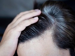Penyebab Rambut Beruban dan Cara Memperlambatnya