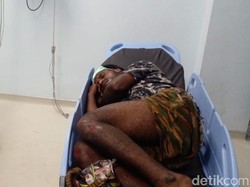 Diduga Mabuk, Pemotor Tabrak Pembatas Jalan Parangtritis Bantul