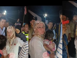Bocah Malaysia Idap Sindrom Manusia Serigala, Wajah Penuh Bulu Sejak Lahir