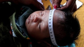 Kepala BGN: Secara Kumulatif Stunting Terbesar Ada di Jawa