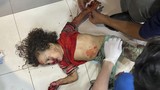rs-al-shifa-gaza-jadi-target-serangan-israel-4_169 rs-al-shifa-gaza-jadi-target-serangan-israel-4_169
