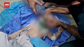 VIDEO: Aksi Heroik Dokter RS Indonesia Gaza Selamatkan Nyawa Bayi